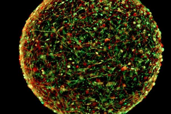 Scientists create mini-brains to study neurological diseases