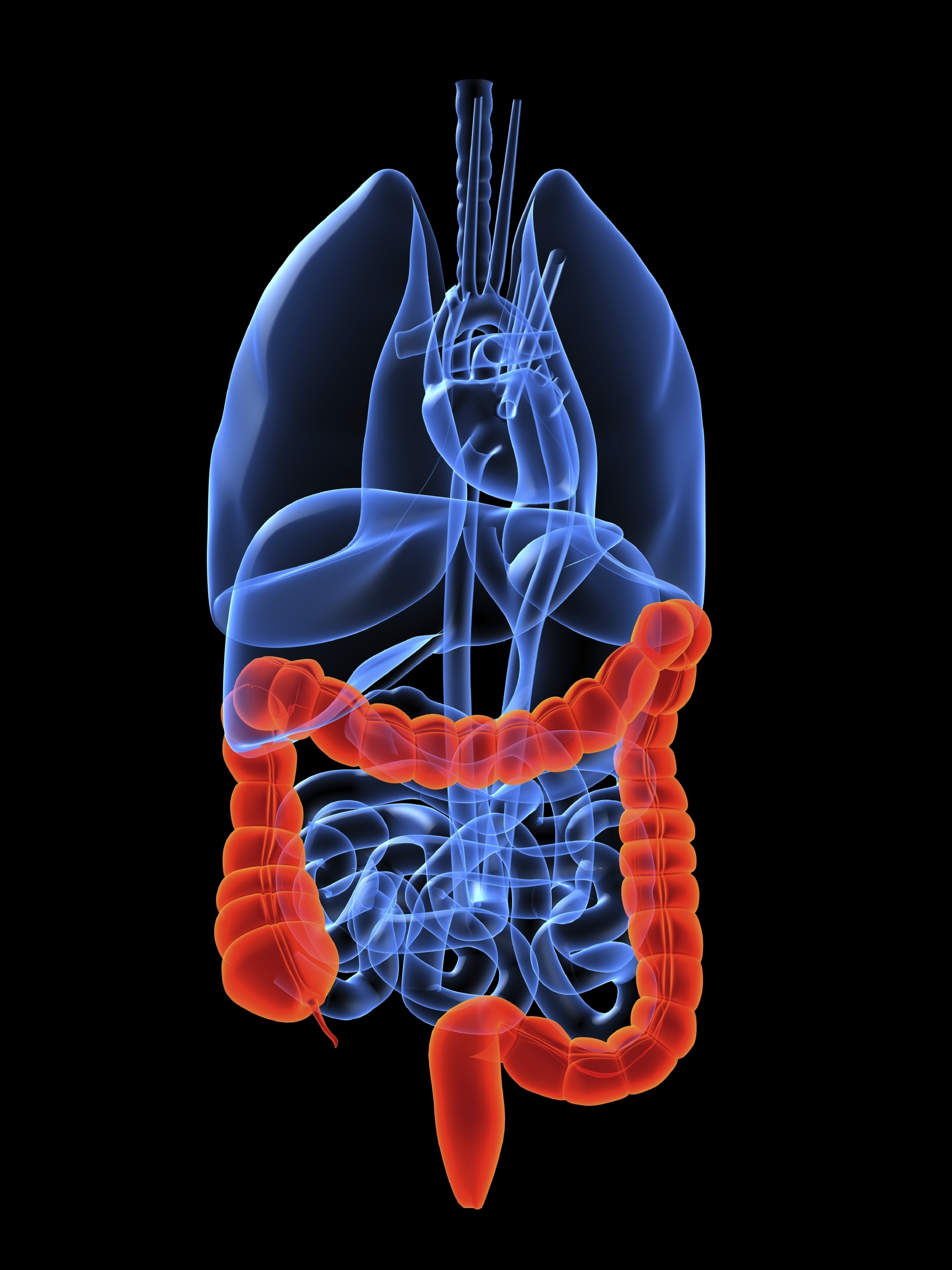 Dietary polyamine intake and colorectal cancer risk in postmenopausal women