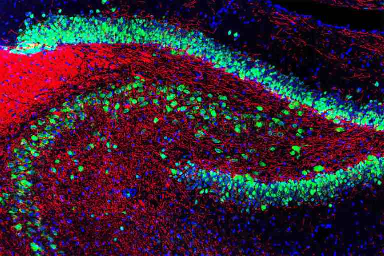 Drug prevents age related brain changes in rats