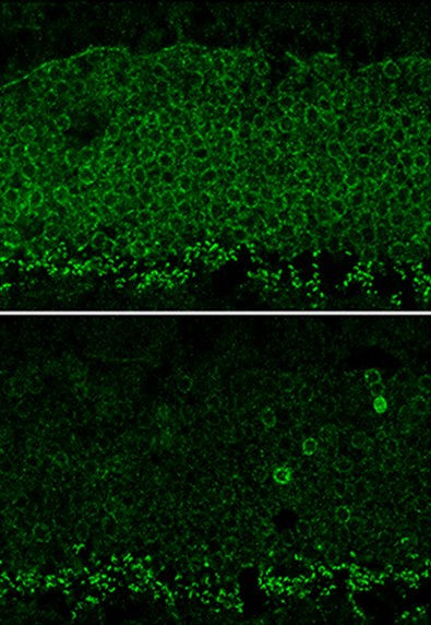 Scientists deploy CRISPR to preserve photoreceptors in mice