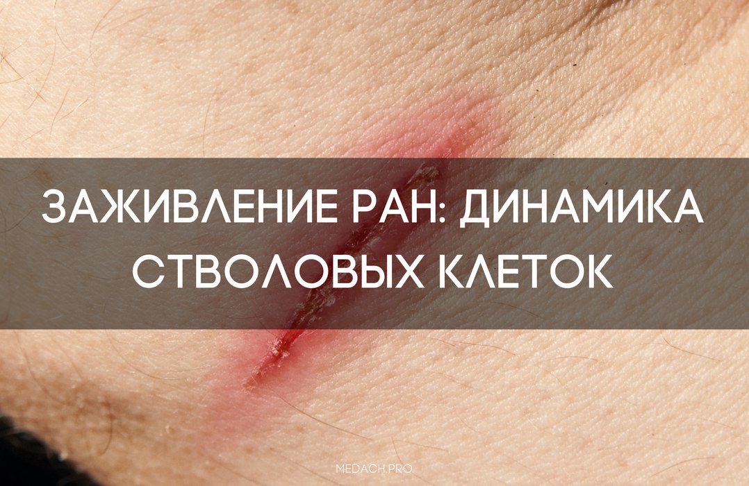 Заживление ран: динамика стволовых клеток