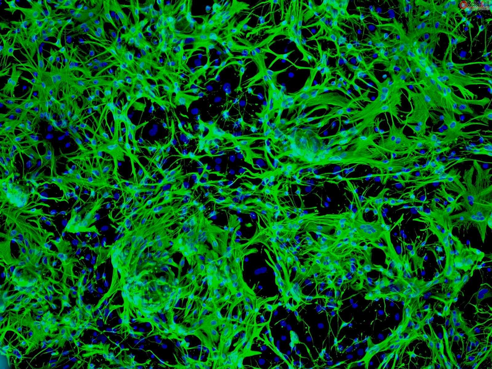 Reprogrammed Glia Improve Symptoms in a Mouse Model of Parkinson’s