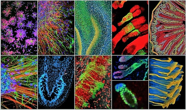 Stem cells - visualising and description