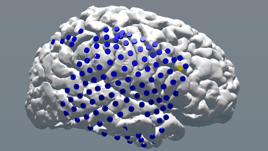 Brain Stimulation Restores Memory During Lapses