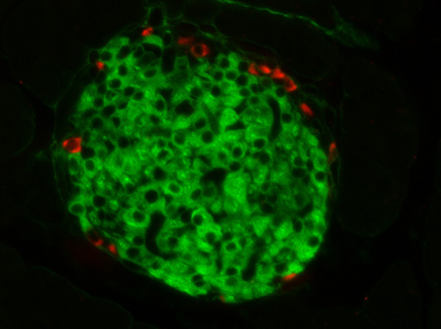 Bioengineering of an Intraabdominal Endocrine Pancreas