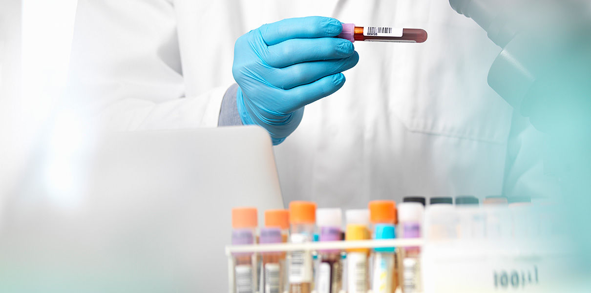 Study: New blood test is more accurate in predicting prostate cancer risk than PSA