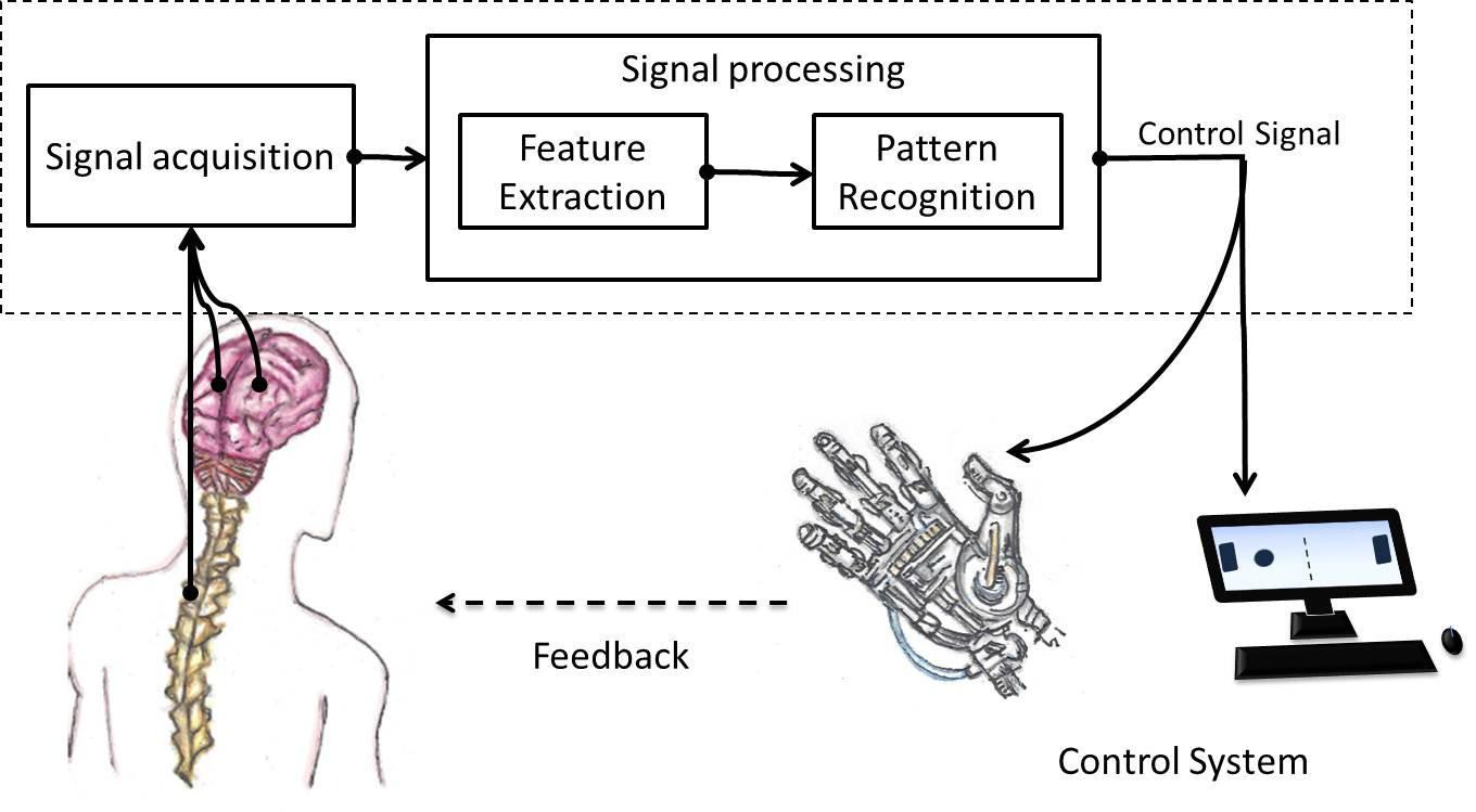 Mind-controlled device helps stroke patients retrain brains to move paralyzed hands