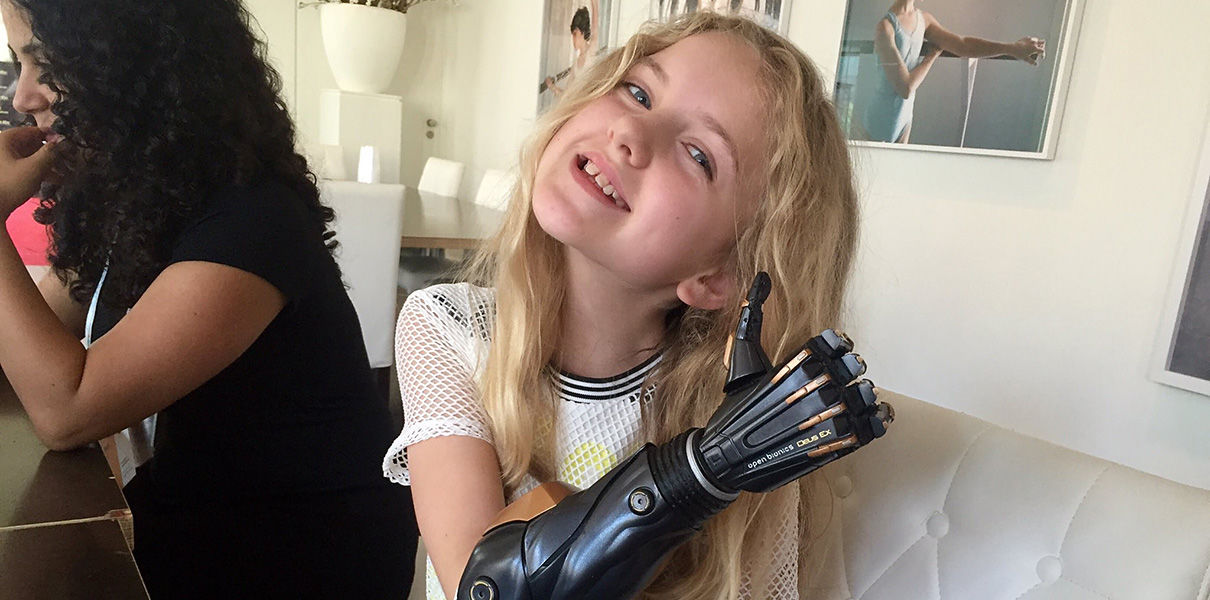 NHS launches world's first trial of 3D printed bionic hands for children