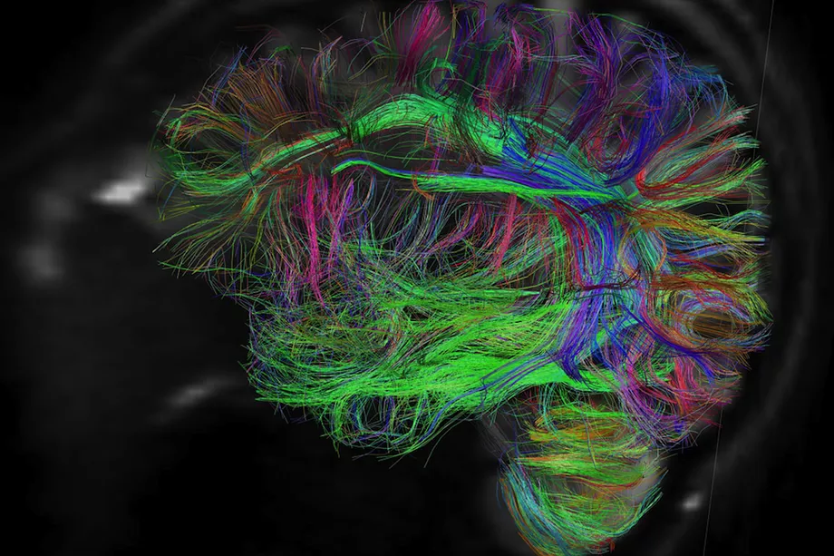 Scientists remotely move a mouse’s whiskers with electrodes outside its brain