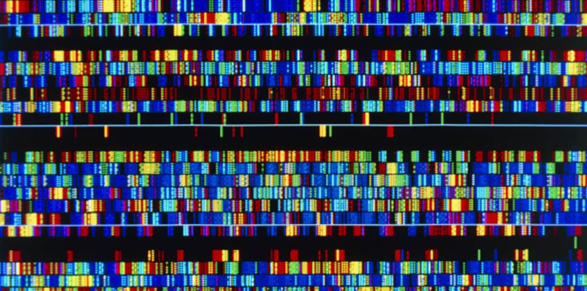 Long-read genome sequencing used for the first time in a patient