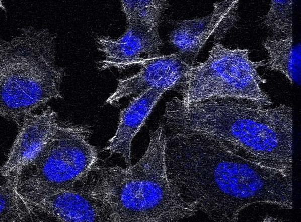 Cancer cells send signals boosting survival and drug resistance in other cancer cells