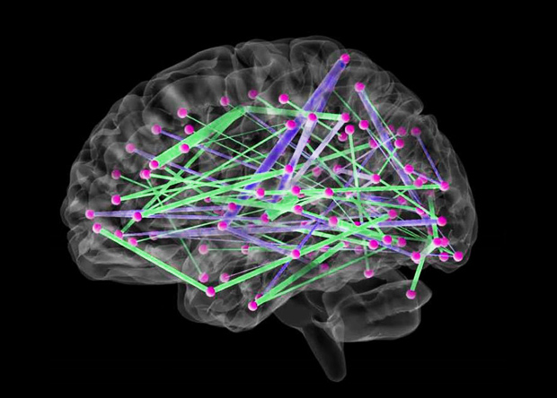 Predicting autism: Study links infant brain connections to diagnoses at age two